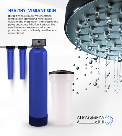 أنظمة السوفتنر في الاردن 